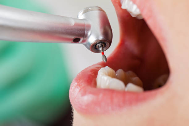 Best Emergency Tooth Extraction  in Elmore, OH